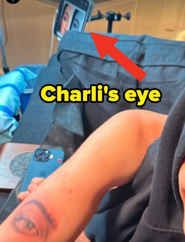charlie's eye tattooed