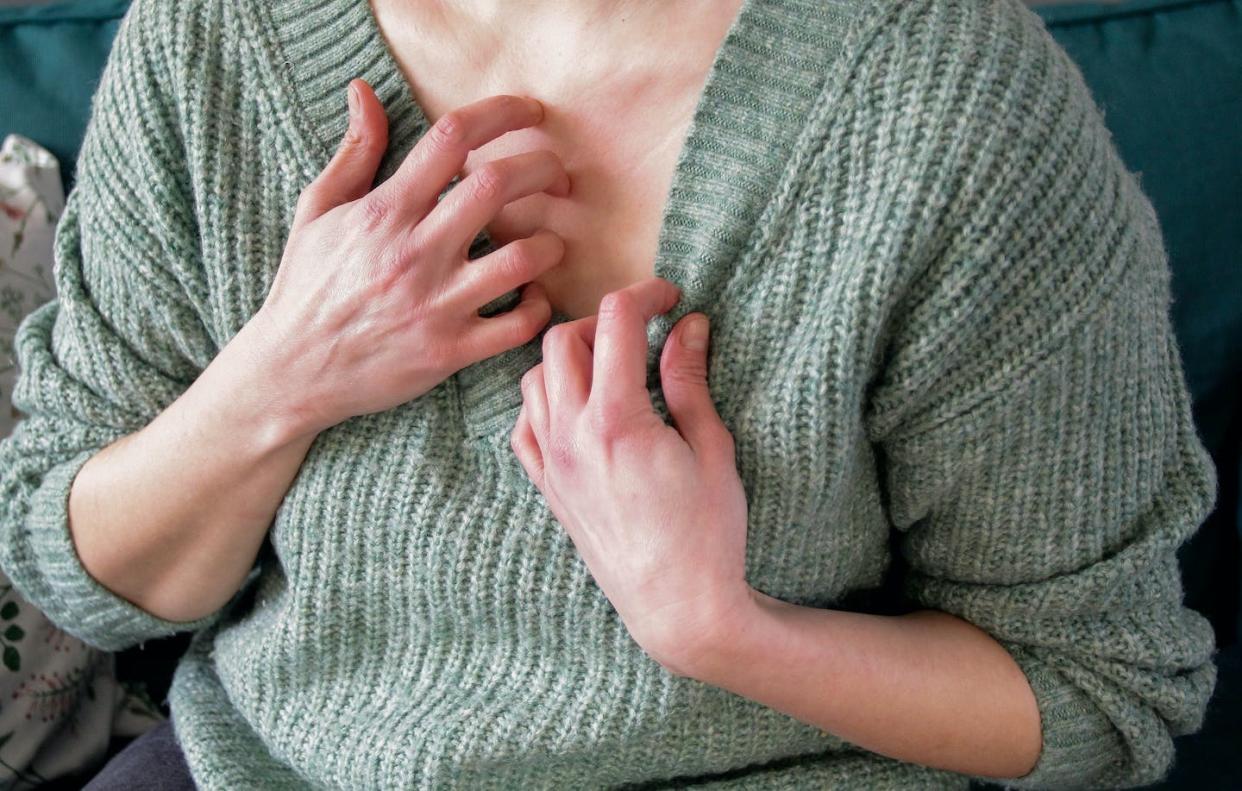 Itching, and the subsequent urge to scratch, can make eczema worse. <a href="https://www.gettyimages.com/detail/photo/scratching-chest-royalty-free-image/1463546524" rel="nofollow noopener" target="_blank" data-ylk="slk:Kinga Krzeminska/Moment via Getty Images;elm:context_link;itc:0;sec:content-canvas" class="link ">Kinga Krzeminska/Moment via Getty Images</a>