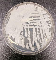 <span class="caption"><em>Candida auris</em> – spreading at a surprising rate.</span> <span class="attribution"><a class="link " href="https://en.wikipedia.org/wiki/Candida_auris#/media/File:Candida-auris_2016-250px.jpg" rel="nofollow noopener" target="_blank" data-ylk="slk:Wikimedia Commons/CDC;elm:context_link;itc:0;sec:content-canvas">Wikimedia Commons/CDC</a></span>