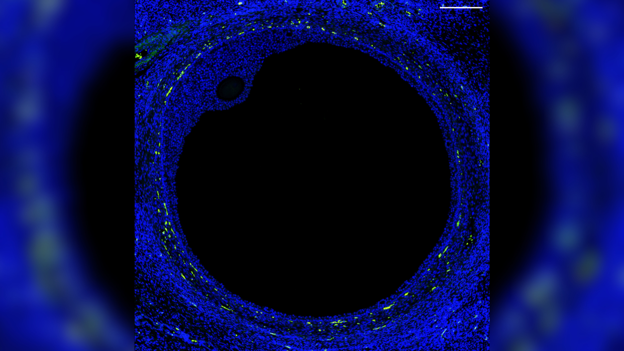  Fluorescent microscope image showing a big black circle taking up most of the image with a small black oval circle at one of the inner points of the circle. Both circles are outlined in blue with yellow dots around the large disc. 