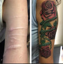 <p>Transforming scars into rose stems [Photo: Instagram/erdogancavdar] </p>