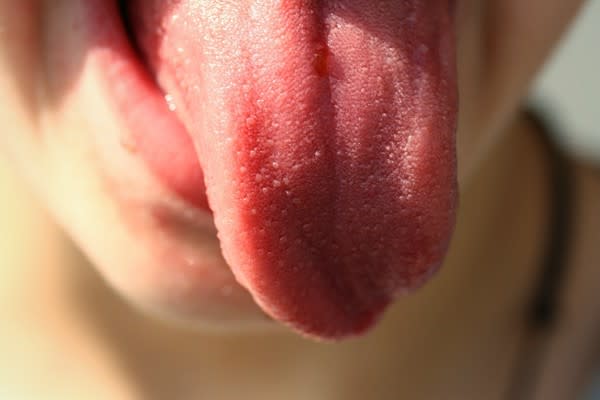 舌頭除了能協助人類品嚐、咀嚼、發聲外，它其實還能反映出一個人的健康狀況。（示意圖／pixabay）