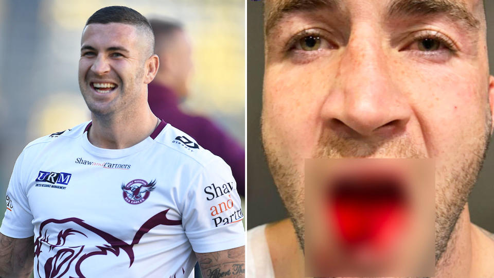 Pictured right, the gruesome tongue injury Joel Thompson suffered against the Knights.