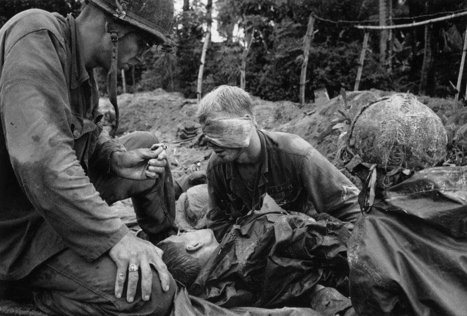 First Cavalry Division medic Thomas Cole, helps an identified soldier in a trench, despite wearing a bandage over the left side of his face. (AP Photo/Henri Huet)