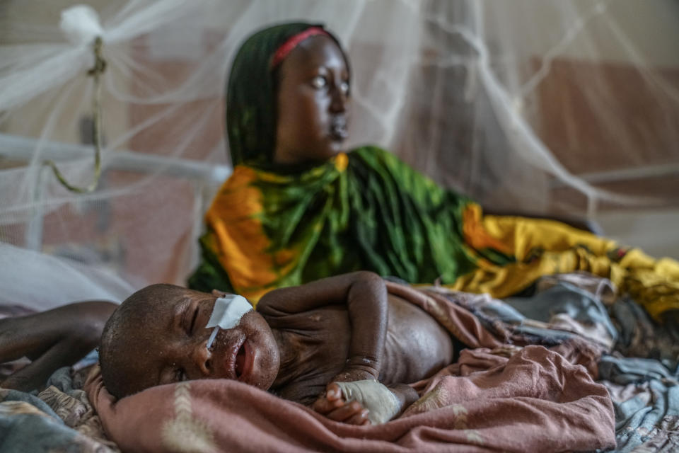 In the severe acute malnutrition ward of the Baidoa regional hospital, a mother lies with her sick child, who first contracted measles before lapsing into the critical stages of malnutrition. (Giles Clarke)