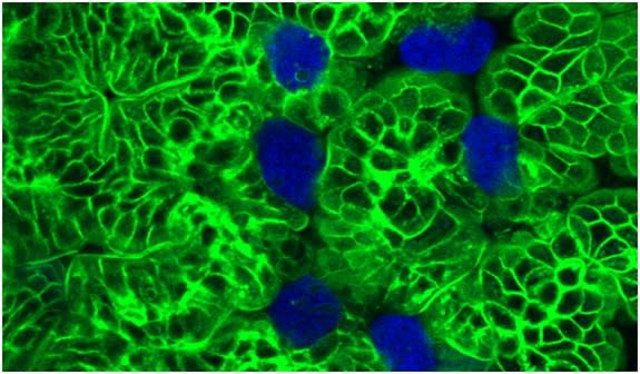 Parasitic amoebae ingesting bites of intestinal cells from a mouse. Tissue was from a mouse expressing membrane-targeted green fluorescent protein (green) and amoebae were pre-labeled with calcein violet (blue).