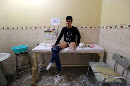 A landmine victim waits for his prosthetics at the Artificial Limb Centre in Basra, Iraq February 28, 2018. REUTERS/Essam Al-Sudani