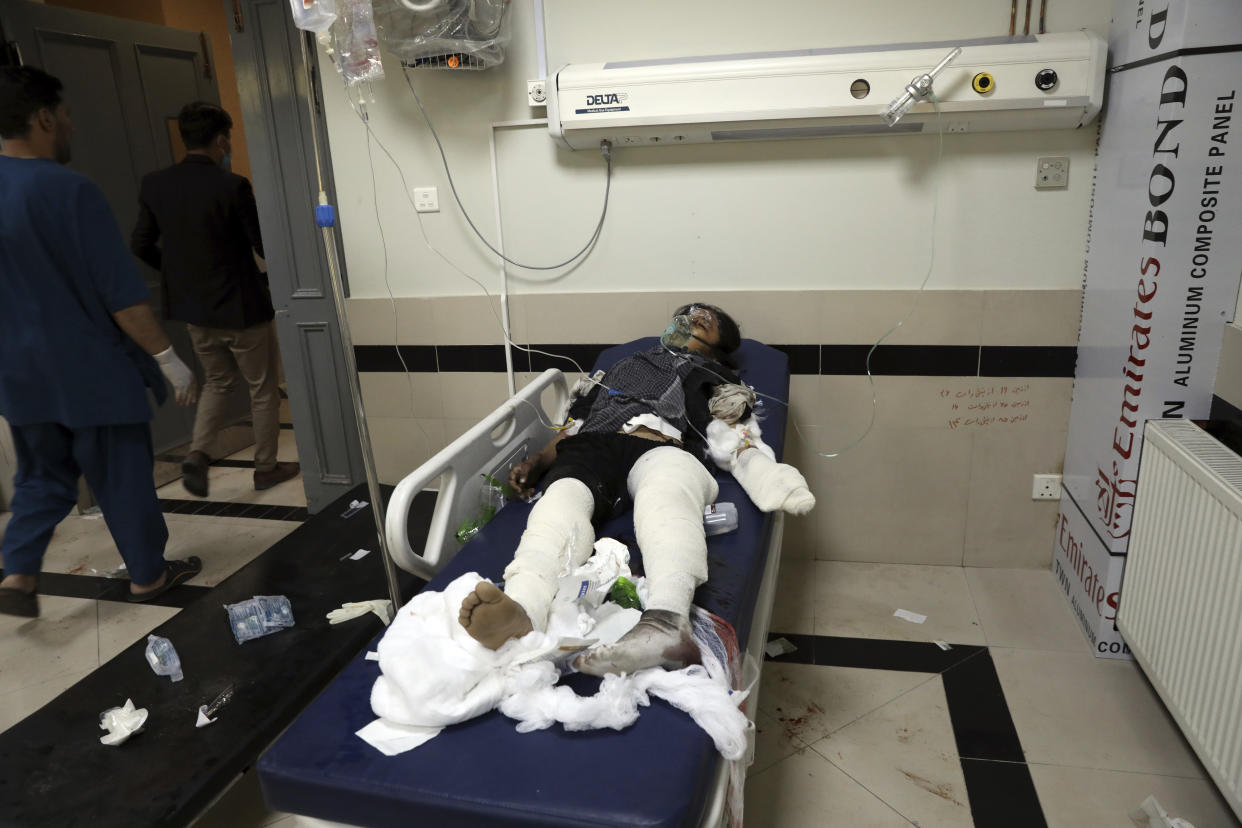 An Afghan school student is treated at a hospital after a bomb explosion near a school in west of Kabul, Afghanistan, Saturday, May 8, 2021. A bomb exploded near a school in west Kabul on Saturday, killing several people, many them young students, an Afghan government spokesmen said. (AP Photo/Rahmat Gul)