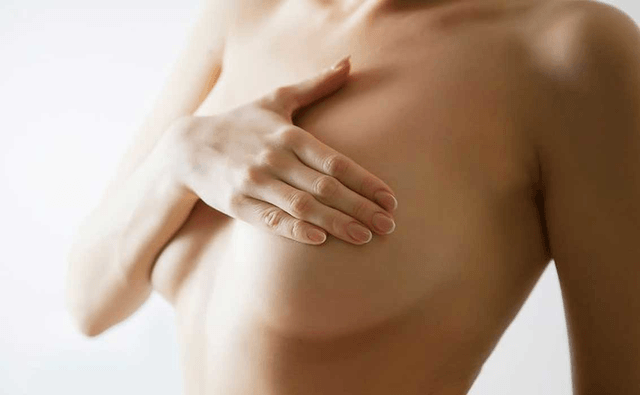 Options for Droopy Breasts – Breast Lift, Implants or Both