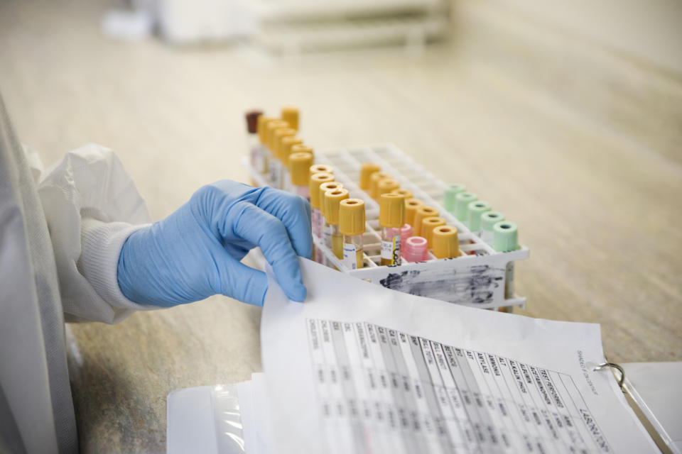 A medical professional's gloved hand retrieving a sheet next to a rack of labeled test tubes