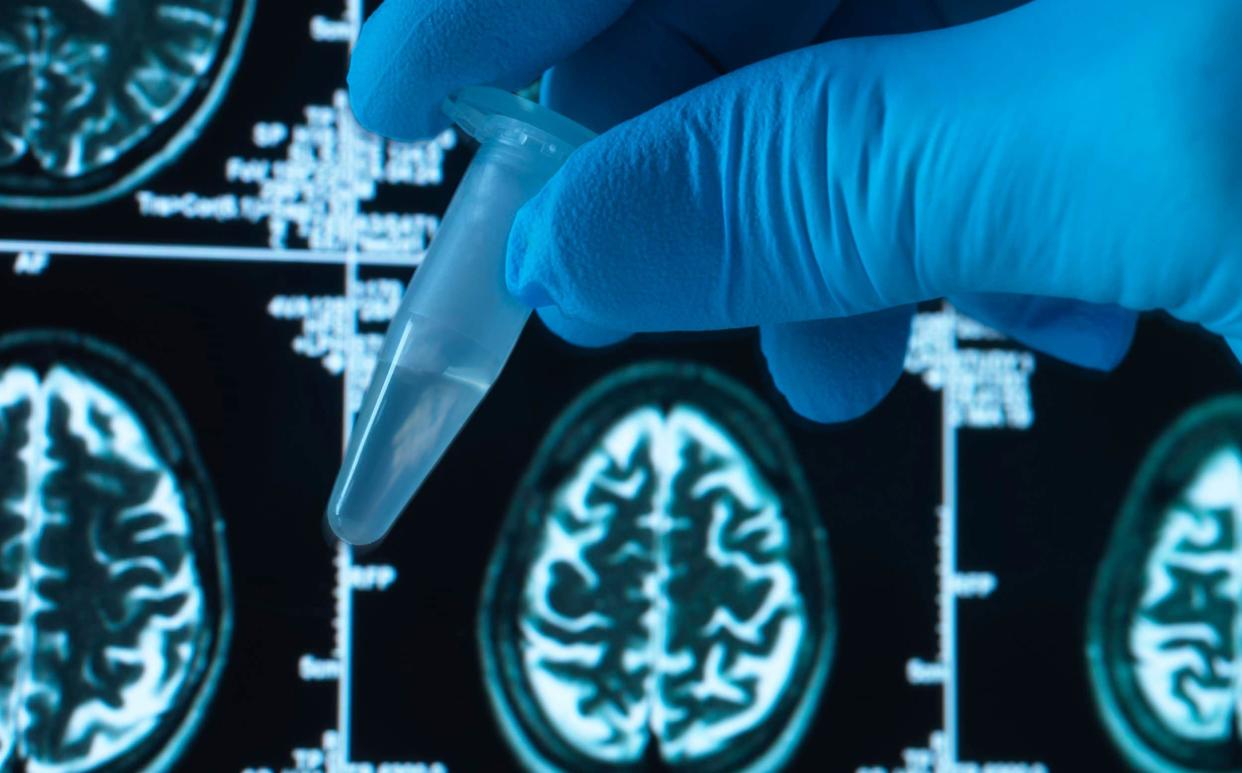 Pharmaceutical research into brain disorders including dementia and alzheimer's - Westend61 