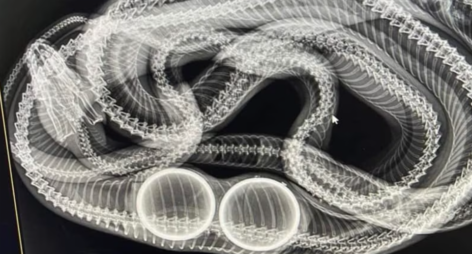 The snake ate tennis balls in a backyard with an X-ray here showing two large circular masses. 