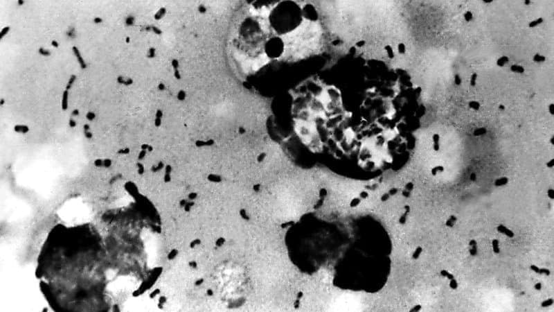 La bact&#xe9;rie de la peste bubonique. - CDC - AFP