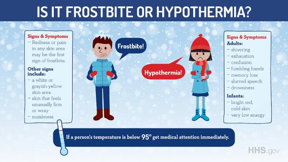 Frostbite and hypothermia