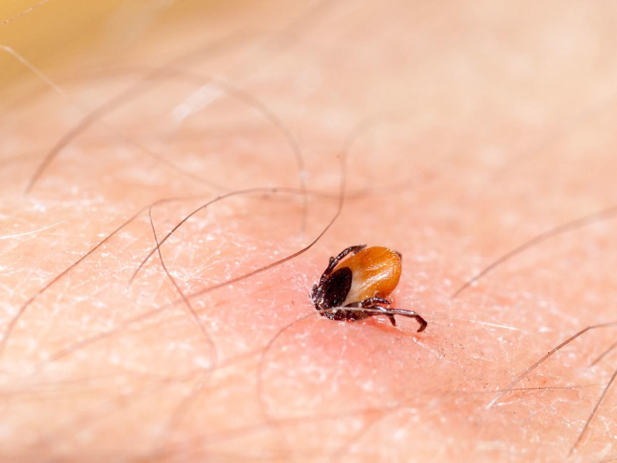 tick on human skin