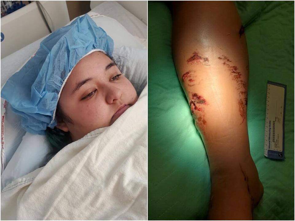 A woman from California was attacked and dragged underwater by a crocodile while vacationing in Mexico.  (Ariana Martinez / KGO)