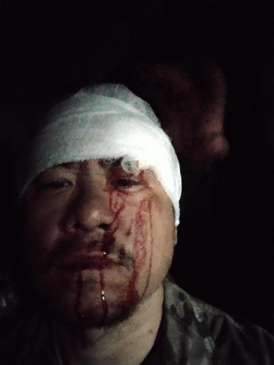 Jackie wearing a bandage over his head with blood on his face