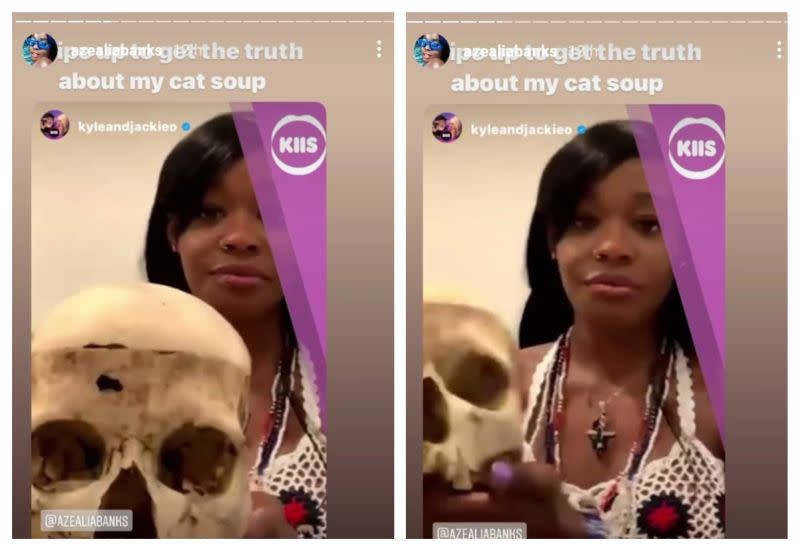 Azealia Banks proudly showing the fractured skull of a six-year-old in an Australia zoom interview. — Instagram screenshot