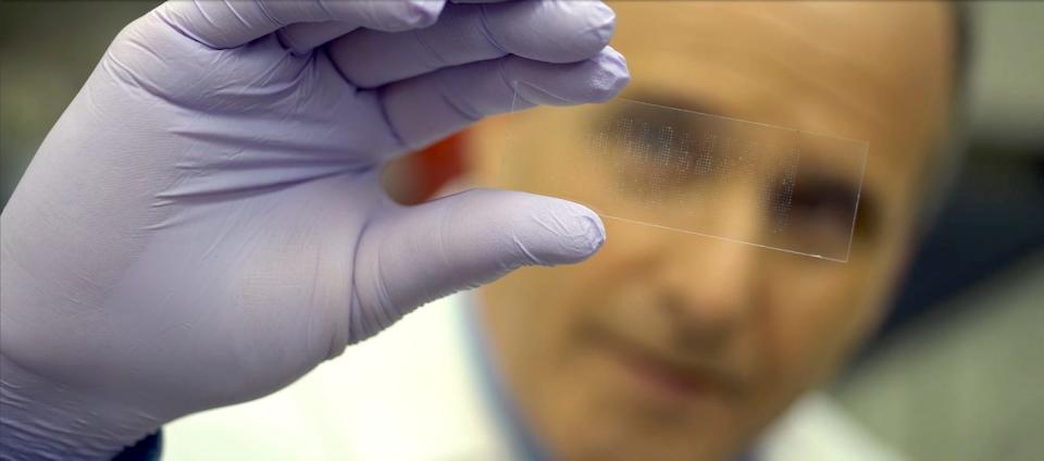 Dr. Joshua LaBaer, the executive director of ASU’s Biodesign Institute, holds up a protein array, a glass slide affixed with thousands of proteins. This tool helps researchers to efficiently look for autoantibodies in blood samples. LaBaer and others on his team think better understanding autoantibodies could be a crucial step in better diagnosing and treating many diseases.