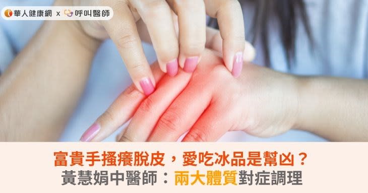 富貴手搔癢脫皮，愛吃冰品是幫凶？黃慧娟中醫師：兩大體質對症調理