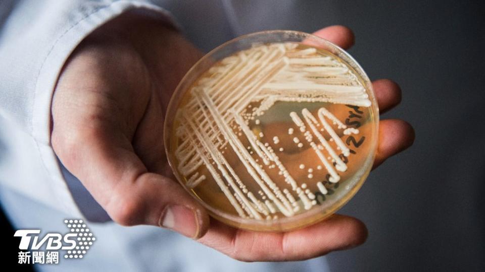 美國出現耳念珠菌大傳染，讓多州不敢輕忽這個威脅。（圖／達志影像美聯社）