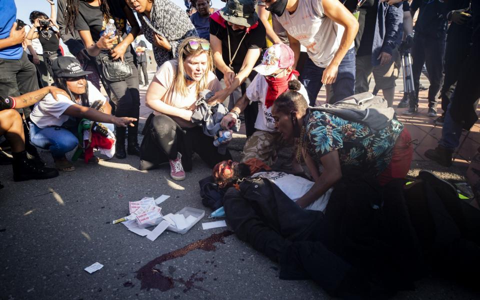 An injured protester lays bleeding on the highway 101 surrounded by others after a Highway Patrol car allegedly drove off during a protest  - Shutterstock