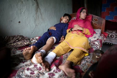 Siblings, who according to family were injured after a cluster bomb that looked like a toy exploded in the hands of a child at home, lay on a bed in village Jabri, in Neelum Valley