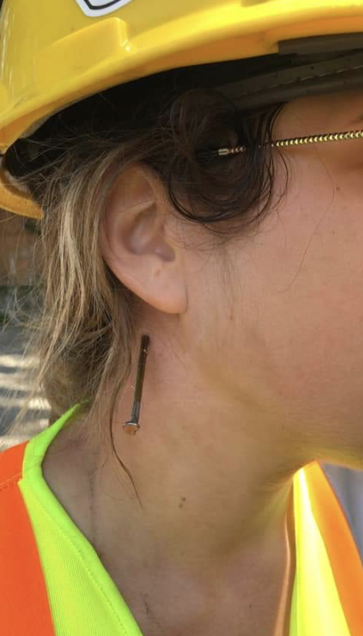 A nail in a construction worker's neck