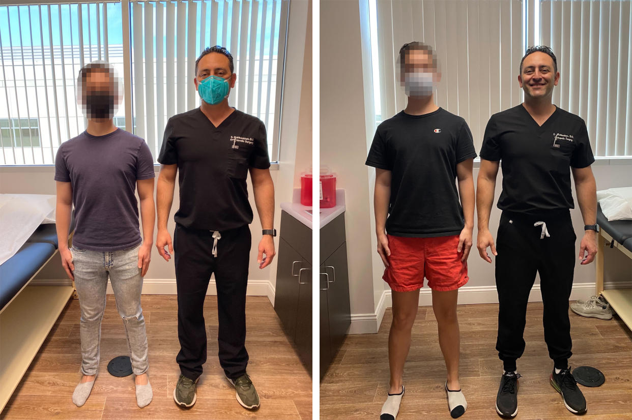 Alex before and after his leg-lengthening surgery next to Dr. Shahab Mahboubian. (Courtesy Dr. Mahboubian)