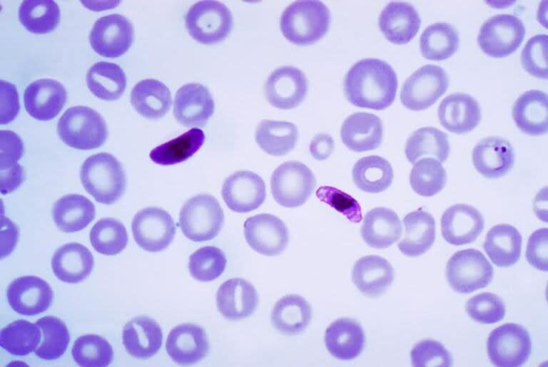 Plasmodium falciparum, un parásito que causa la malaria cerebral