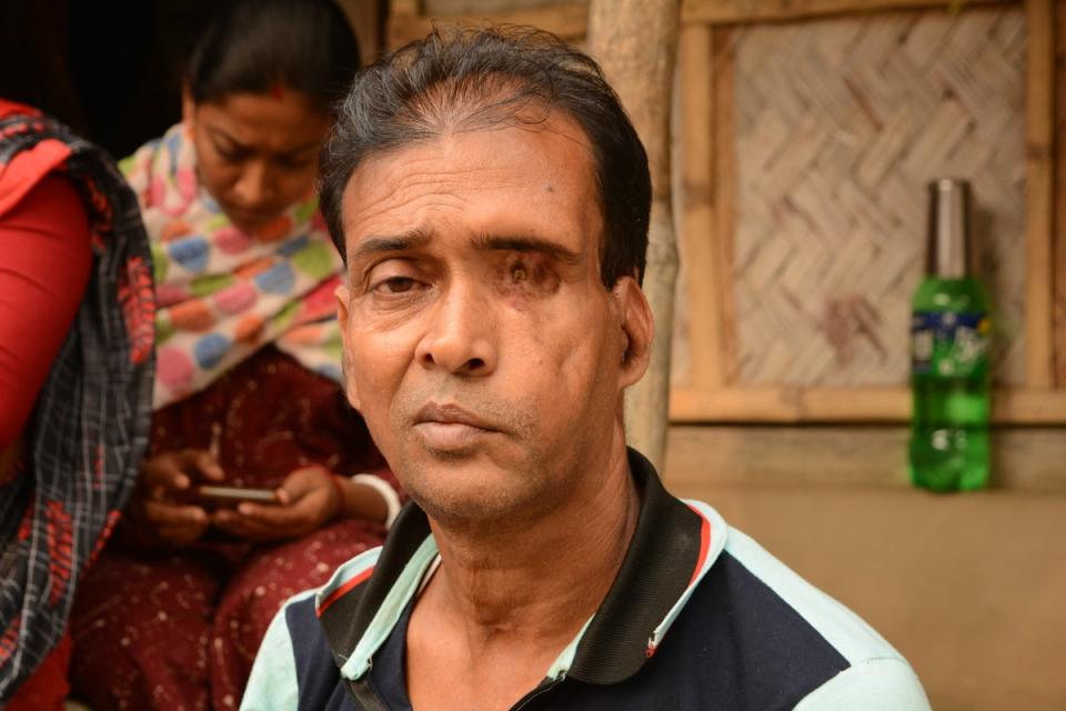 Mihir Sardar, 52, survived a tiger attack in the Sundarbans (Namita Singh/ The Independent)