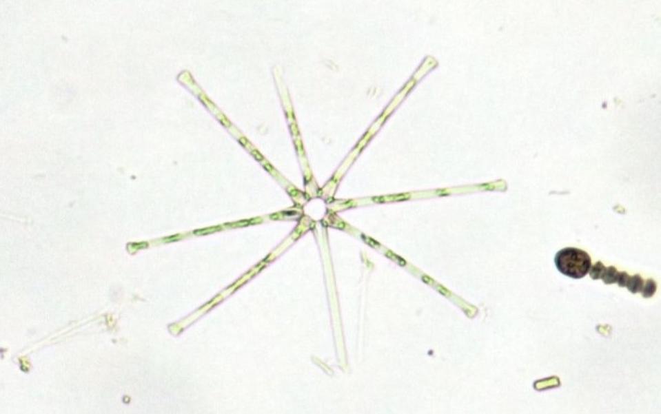 A close-up of a diatom.  It looks like there are eight arms coming out of a center.