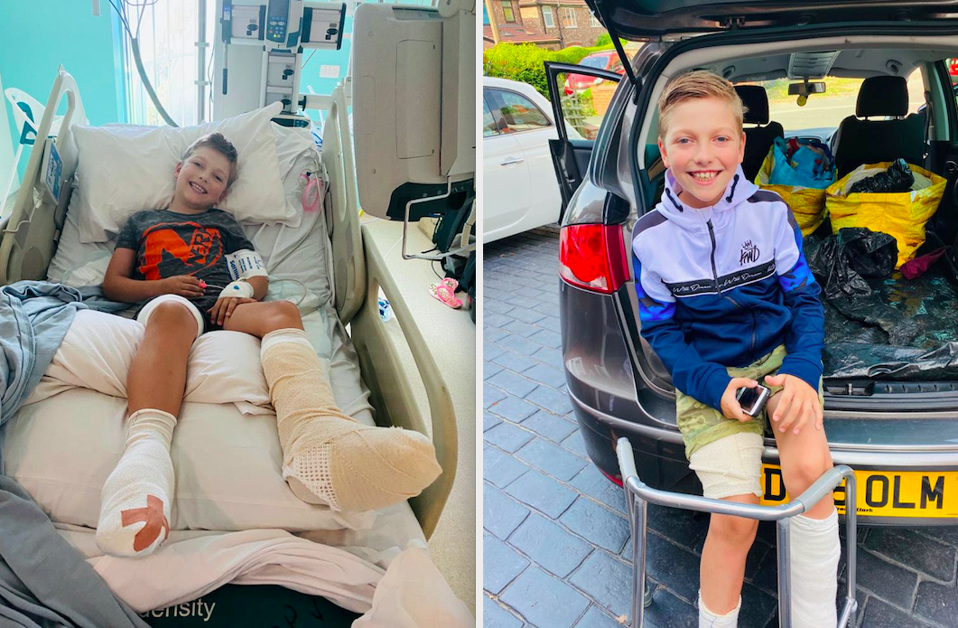 Will Tyler is now able to walk unaided and wears compression socks 23 hours a day to protect the scars as well as a splint at night. (SWNS)