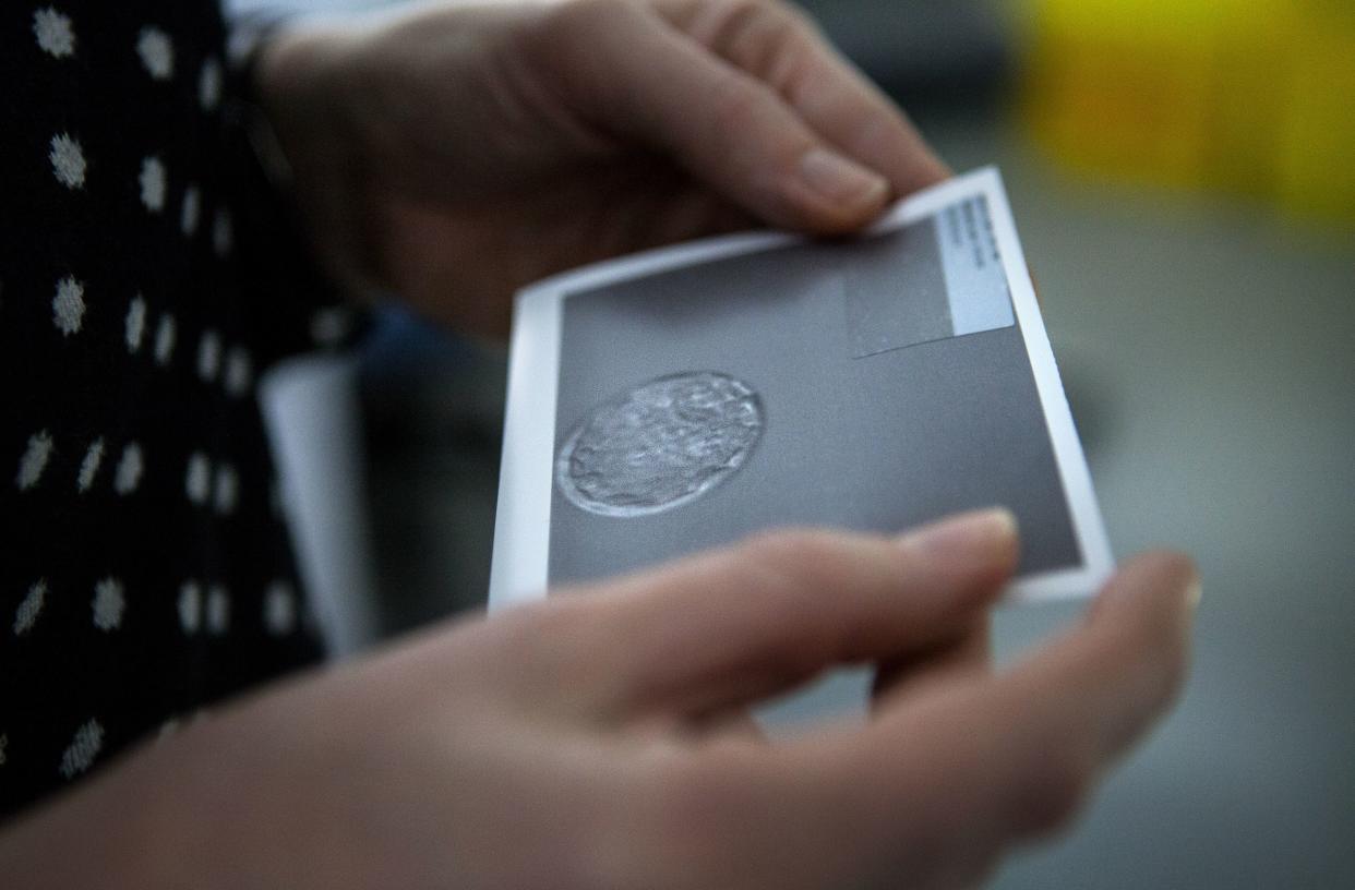 A woman going through IVF holds a printed image of an embryo.