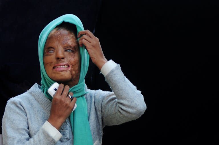 Acid attack survivor, Sonali Mukherjee, pictured outside her temporary home in New Delhi, on December 6, 2012. When Sonali rejected the advances of three of her fellow students, they responded by melting her face with acid. But rather than hide herself away, the 27-year-old applied to appear on India's most watched TV quiz show -- and walked away as a millionaire