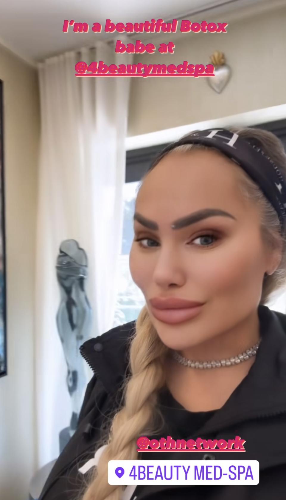 ‘90 Day Fiance’ Alum Darcey Silva Unrecognizable After Latest Plastic Surgery Procedure- ‘Botox Babe’