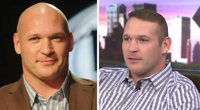 Brian Urlacher Had Surgery for 8 Hours to Get His Hair Back