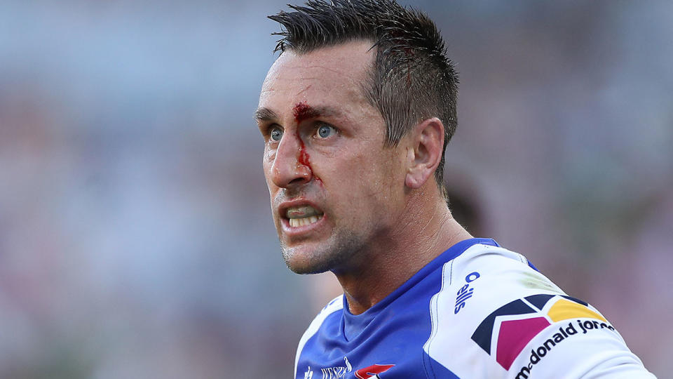 Seen here, Mitchell Pearce has blood dripping down his face during an NRL match for the Knights.