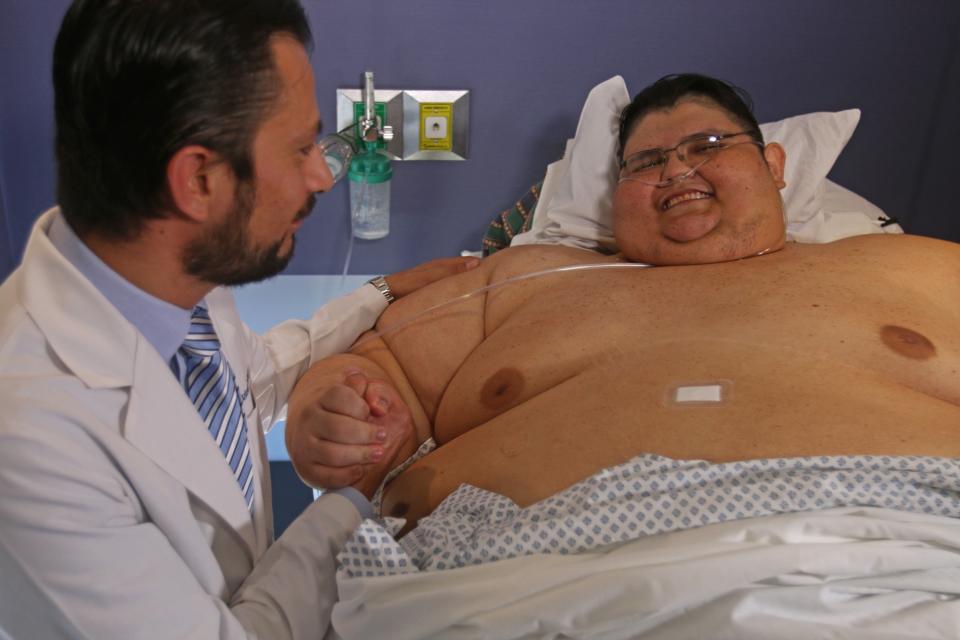 La operación en México que le hicieron al hombre más obeso del mundo