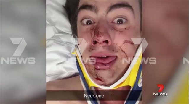 The crowd surfer appeared in good spirits in sharing this selfie of the aftermath. Picture: 7 News