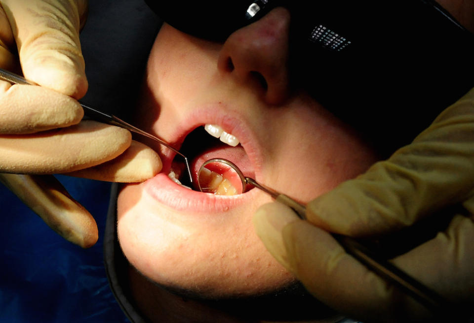 Thousands of people in Devon and Cornwall are on the waiting list for an NHS dentist (Picture: PA)