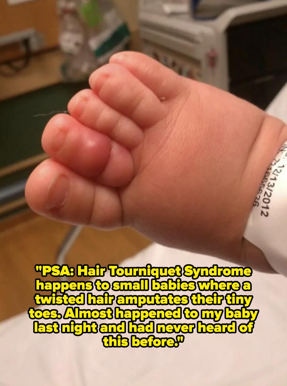 Close-up of a baby's foot held gently, hospital band visible on the wrist