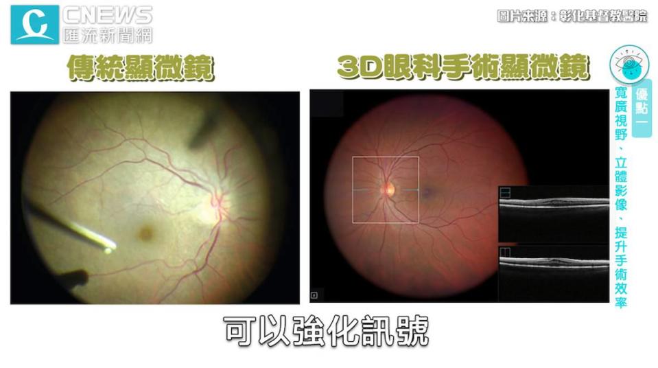 cnews資料照片