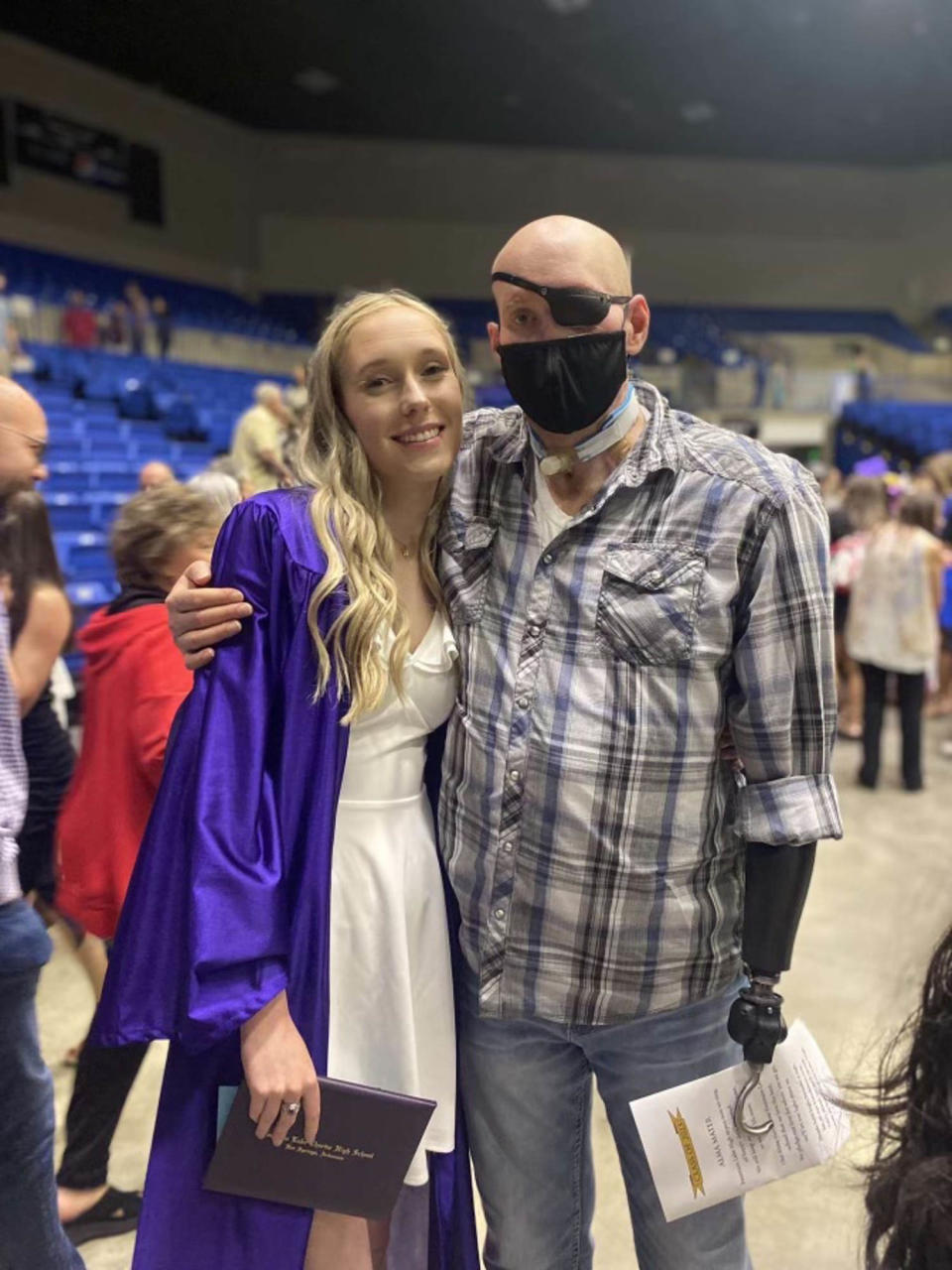 Aaron James with his daughter Allie before the operation. (Courtesy James family)