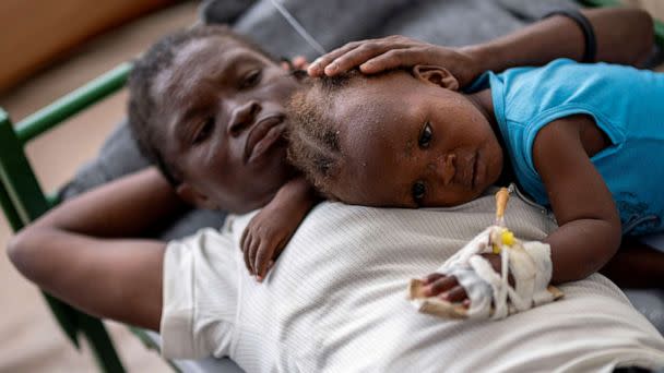 PHOTO: Karina Joseph, 19, comforts her 2-year-old child Holanda Sineus as she receives treatment for cholera in a tent at a Doctors Without Borders hospital in Cite Soleil, a densely populated commune of Port-au-Prince, Haiti, Octt. 15, 2022. (Ricardo Arduengo/Reuters)