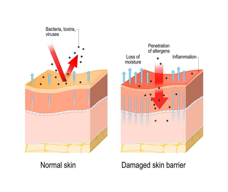 Diagrams demonstrating the difference between healthy and dry skin