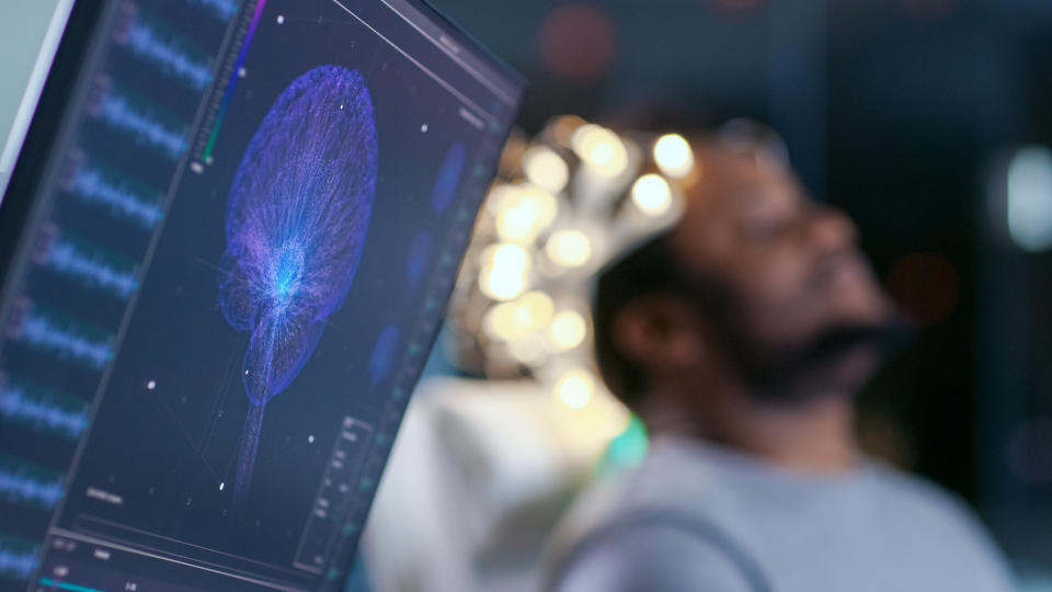 Los monitores muestran la lectura del electroencefalograma y un modelo gráfico del cerebro. En el laboratorio de fondo, un hombre con auriculares de exploración de ondas cerebrales sentado en una silla con los ojos cerrados. En el moderno laboratorio de investigación de estudios cerebrales (Getty Cretive)