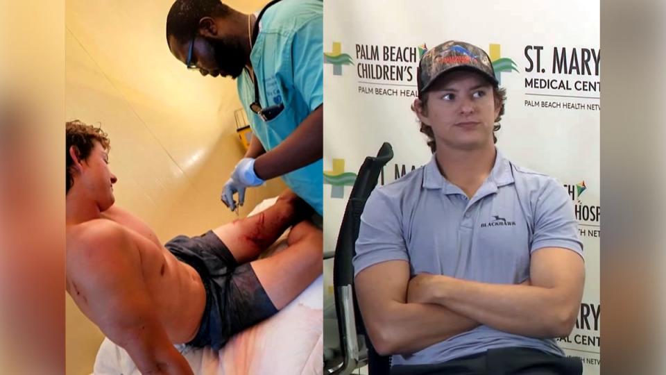 Marlin Wakeman, 24, seen having treatment (left) after being attacked by two sharks in the Bahamas (ABC News 10/WPLG/CNN/Marlin Wakeman)
