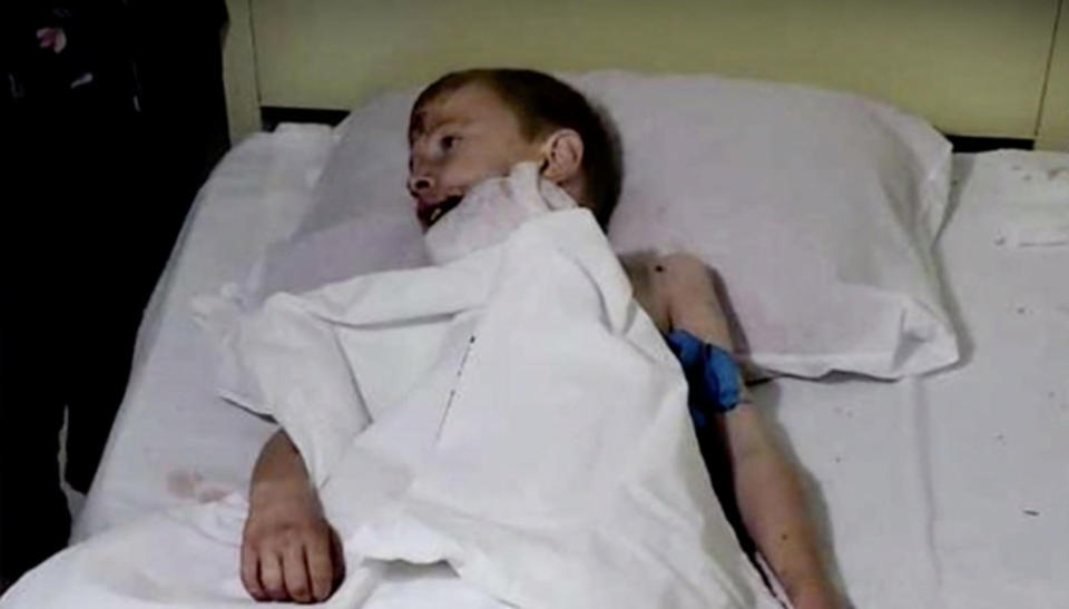 Pictured is a boy in a hospital bed after the attack in Mexico in which nine people died.