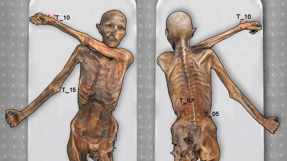 Ötzi had tattoos on various parts of his body.  - EURAC Research Institute for Mummy Studies/Marco Samadelli